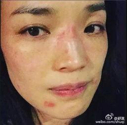 明星网红推荐防晒霜,夏日防晒新宠盘点